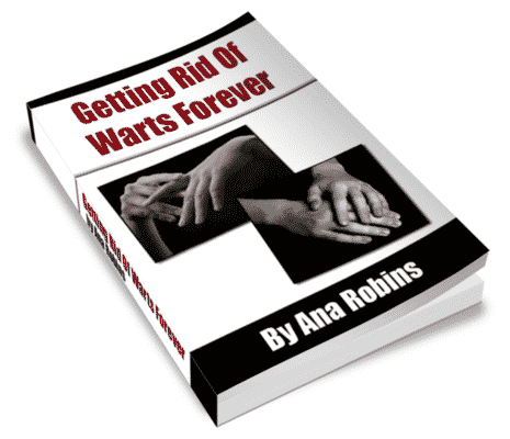 Getting Rid Of Warts Forever Getting Rid Of Warts Forever