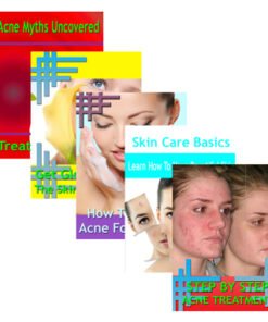 Beating Acne 5 Guides Collection
